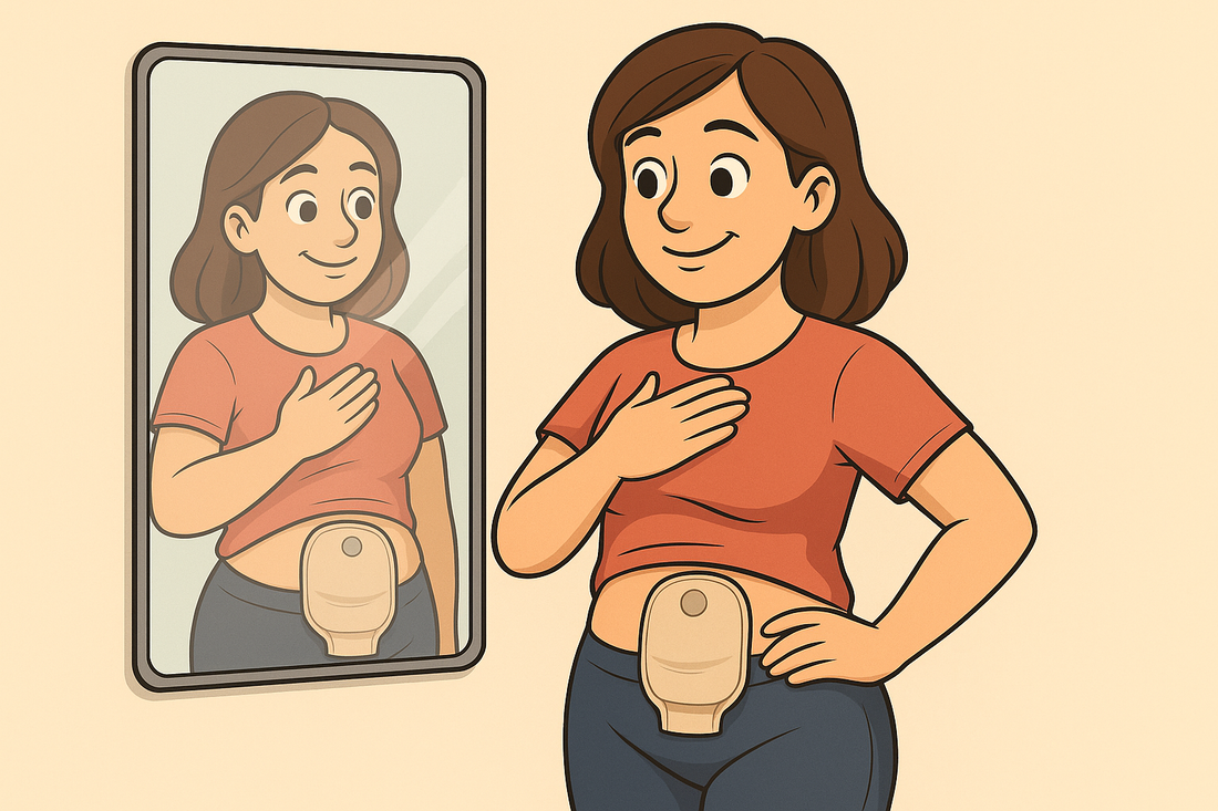 Living Confidently With a Stoma – Real Talk About Mindset, Body Image & Self-Acceptance