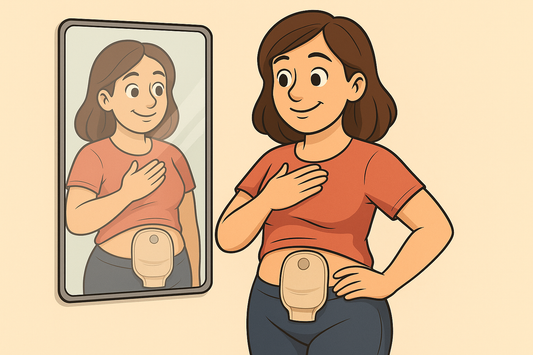 Living Confidently With a Stoma – Real Talk About Mindset, Body Image & Self-Acceptance