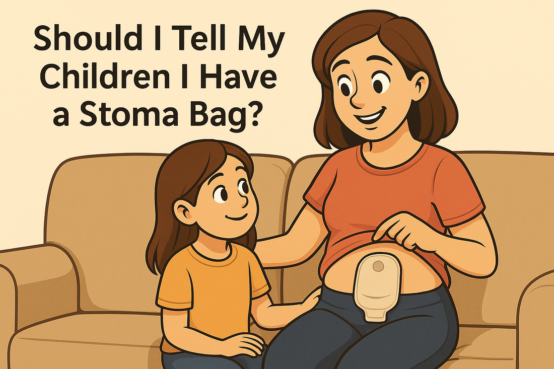 Should I Tell My Children I Have a Stoma Bag? A Guide for Parents